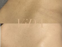 ヴィーダ 渋谷松濤(ViDA)/背中のくすみ/ザラつき改善