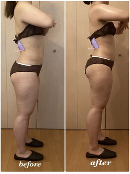 アンフィニ(infini)/短期集中コース8回目(3ヶ月)