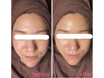 マリーメリー(marie merry)/艶肌wax＋プラズマシャワー