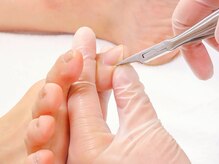 かろやかの雰囲気（ドイツ製ニッパーを使用して丁寧にケア♪巻き爪が楽に♪）