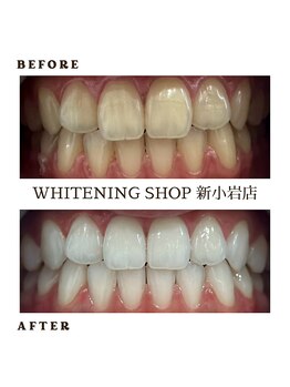 ホワイトニングショップ 新小岩店/歯科提携 ホワイトニング専門店