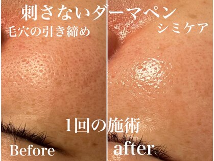 ユアン(YUAN)の写真