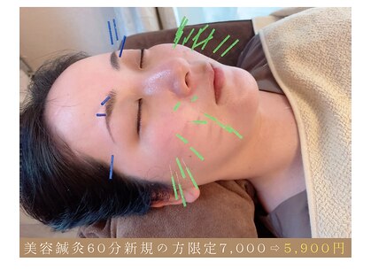 ミフール鍼灸院の写真