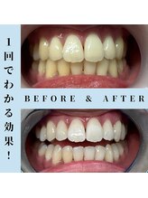 ドルチェ 水戸店(Dolce)/★ before → after ★