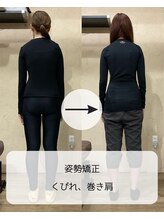 伊集院鍼灸整骨院 千葉中央院/姿勢矯正、巻き肩、くびれ