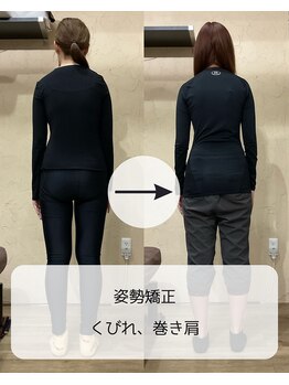 伊集院鍼灸整骨院 千葉中央院/姿勢矯正、巻き肩、くびれ