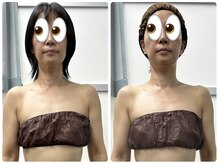 ソレイユ ベル(Soleil Belle)/☆施術例☆