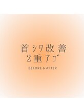 ミーティア(Meteor)/