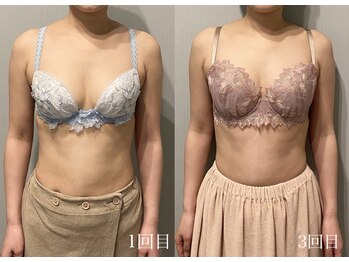 ティアモ(Ti Amo)/Before/After