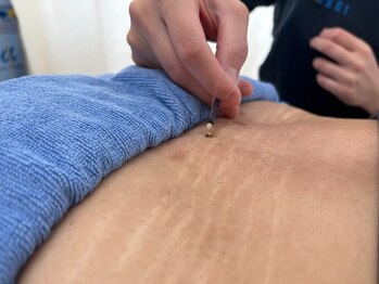 宮町鍼灸整骨院/自律神経系の不調にも◎