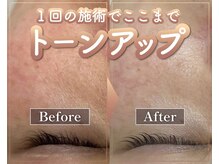 ウィンウィン 新山口店(Win Win)/トーンアップ！