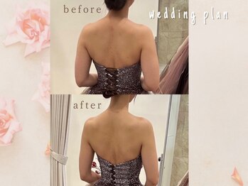 エステティックサロン アールグレー 名古屋駅店/一生で一度の自分史上最高の日に