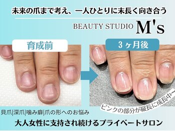 エムズ(M's)/自爪育成