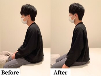 ソレア(Solea)/姿勢改善1回目 Before/After