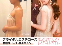 痩身&ブライダルエステサロン MillS 小倉店【3/2 NEW OPEN（予定）】/ブライダルエステコース