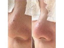 ベベ(bebe)の雰囲気(1度の施術でも変化に満足出来る☆)