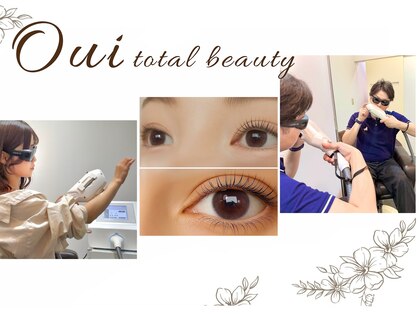 ウィ(Oui)の写真