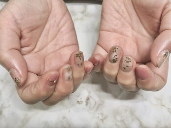 ヴィプラス(Vi+)/