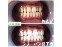 ルブラン 奈良店(Le Blanc)/最低保証付きフリーパス