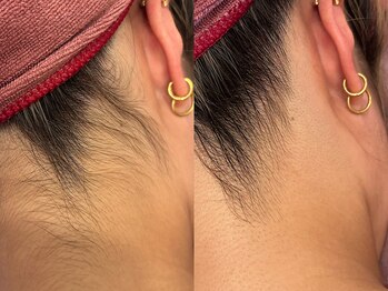 ビューティービレッジ(Beauty village)/骨格に合わせたうなじデザイン