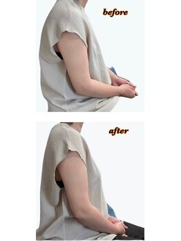 メンズアンドレディース エステティックサロン ティアラ(TiaLa)/【痩身】骨盤から整える痩身ケア