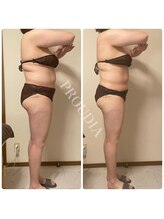 プラウディア(PROUDIA)/痩身専門店/ダイエットサロン