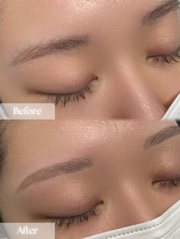 アップユー(UPU)/眉毛 ビフォーアフター