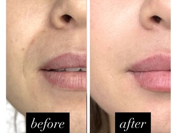 チャルム(CAL'ME)