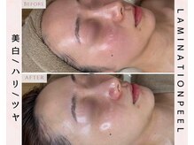 ルリエベル(Relier Belle)/ペプチド肌貯金★肌育ラミピール