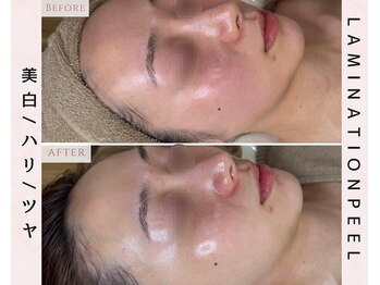 ルリエベル(Relier Belle)/ペプチド肌貯金★肌育ラミピール