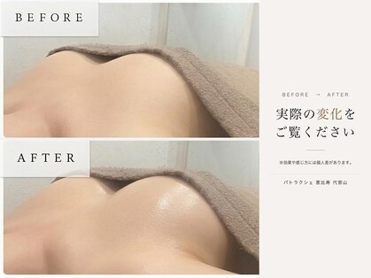 パトラクシェ 恵比寿 代官山(Patolaqshe)の写真