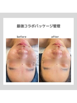 ポムハヌル(pom.haneul)/韓国肌管理室