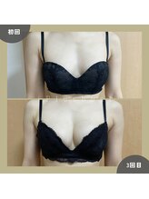 プラス バスト(+Plusバスト)/お客様BeforeAfterお写真