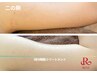 【二の腕ボツボツ・黒ずみ改善】REVIハーブピーリング17,600→8800