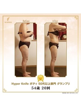 エクラ(eclat)/ハイパーナイフコンテスト画像♪