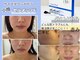 サロン エム(Salon M)の写真