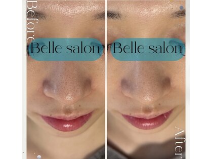 ベルサロン(Belle salon)の写真