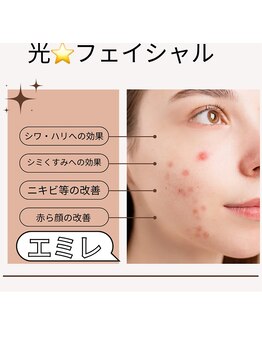 エミレ(EMIRE)/光で綺麗に