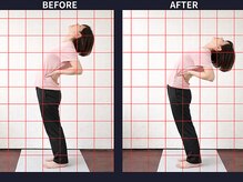 さいとう治療院 新百合ヶ丘/背中腰・骨盤矯正による後屈