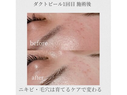 オンド(OND)の写真