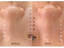 リアン(Lien)の雰囲気（今から夏に向けてのおすすめメニューです！美しいツヤ肌に。）