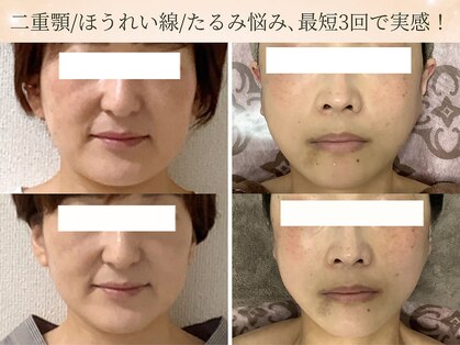 エミルカ 仙台(EMILUCA)の写真