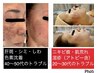 エイジング肌悩み【ホームケアの32倍】業界初の30％高濃度★ヒト幹細胞導入40