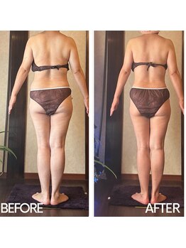 アーユルヴェーダアンドアロマエステ アユス(AYUS)/40代痩身 ウエスト-14.5cm