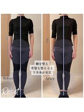 リセット(Reset)/フェムケア矯正(R)Before/After