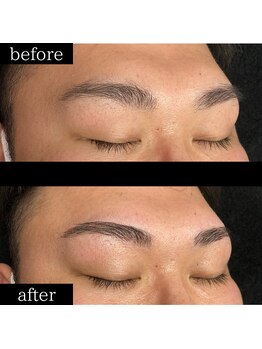 ユー 千葉駅前店(you)/症例写真