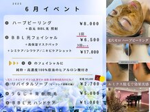 エテ(ete)