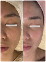 クールグラシュー(couer gracieux)/#最強の肌質改善