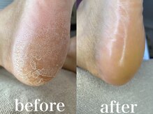 #けあなちゅらる