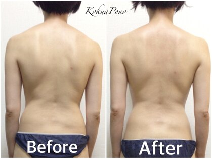 コクアポノ(Kokua Pono)の写真